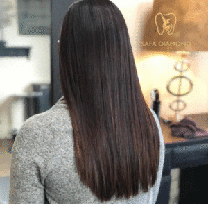 احسن دكتور متخصص في علاج الشعر في جدة: 0546444116