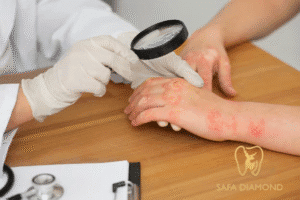 افضل دكتور جلدية في جدة لعلاج الأكزيما: 0546444116