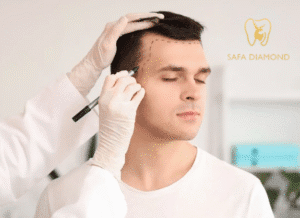 زراعة شعر بجدة: 0546444116