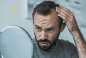 علاج الصلع الأمامي عند الرجال: 0546444116