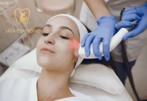 إزالة تصبغات الوجه بالليزر: 0546444116