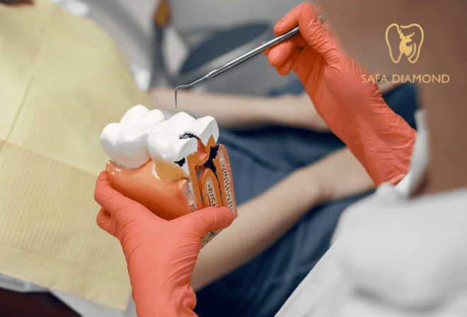 أفضل دكتور خلع ضرس العقل في جدة: 0546444116