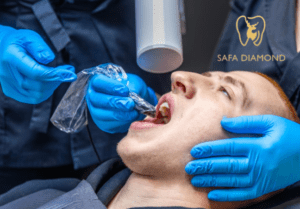 أفضل دكتور خلع ضرس العقل في جدة: 0546444116