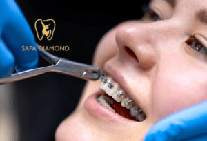 أفضل عيادة أسنان في جدة للتقويم: 0546444116