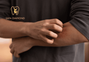 افضل دكتور جلدية في جدة للحساسية: 0546444116